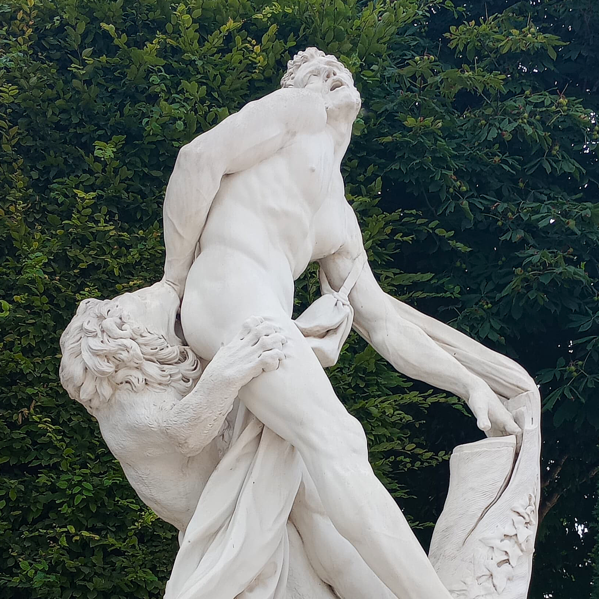 On Versailles, Kidney Stones, Music, and Dissonance